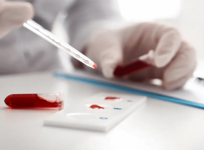 Krvní test s kapátkem pro analýzu hemoglobinu